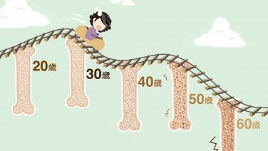 更年期小知识   活学饮食窍门预防骨质疏松
