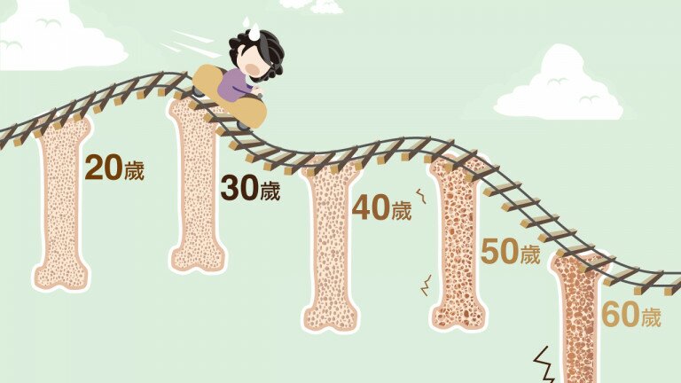 更年期小知识   活学饮食窍门预防骨质疏松
