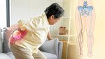 長者腰背腳痛莫輕視！ 認識坐骨神經痛 