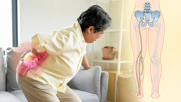 长者腰背脚痛莫轻视! 认识坐骨神经痛