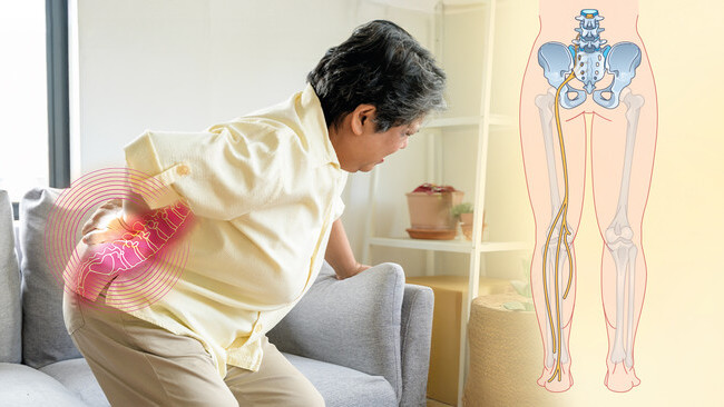 长者腰背脚痛莫轻视！ 认识坐骨神经痛