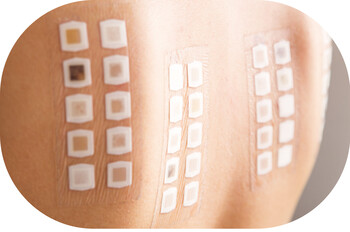 皮膚斑貼測試