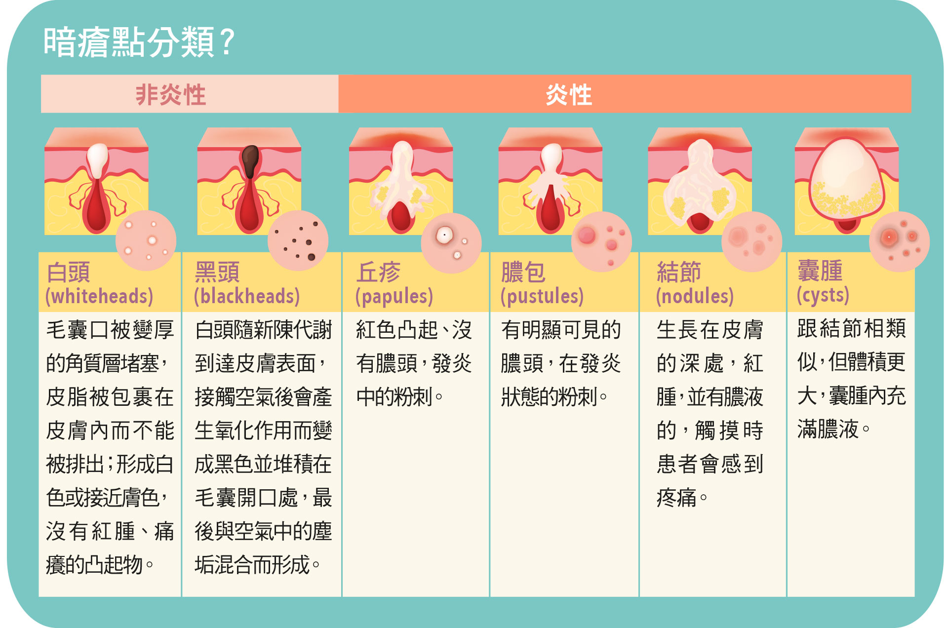 暗瘡點分類？  