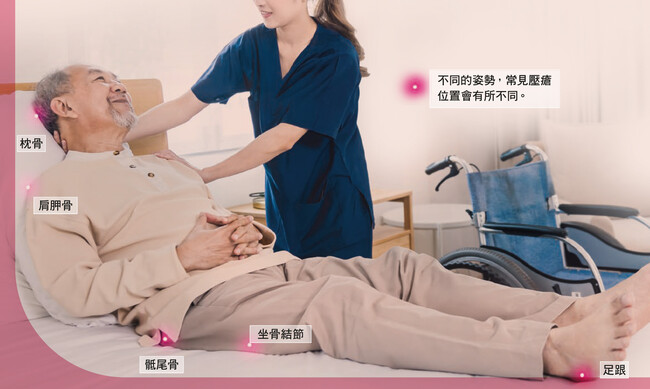 壓瘡的成因