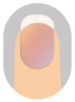 指甲呈紫色
