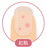 出現斑點