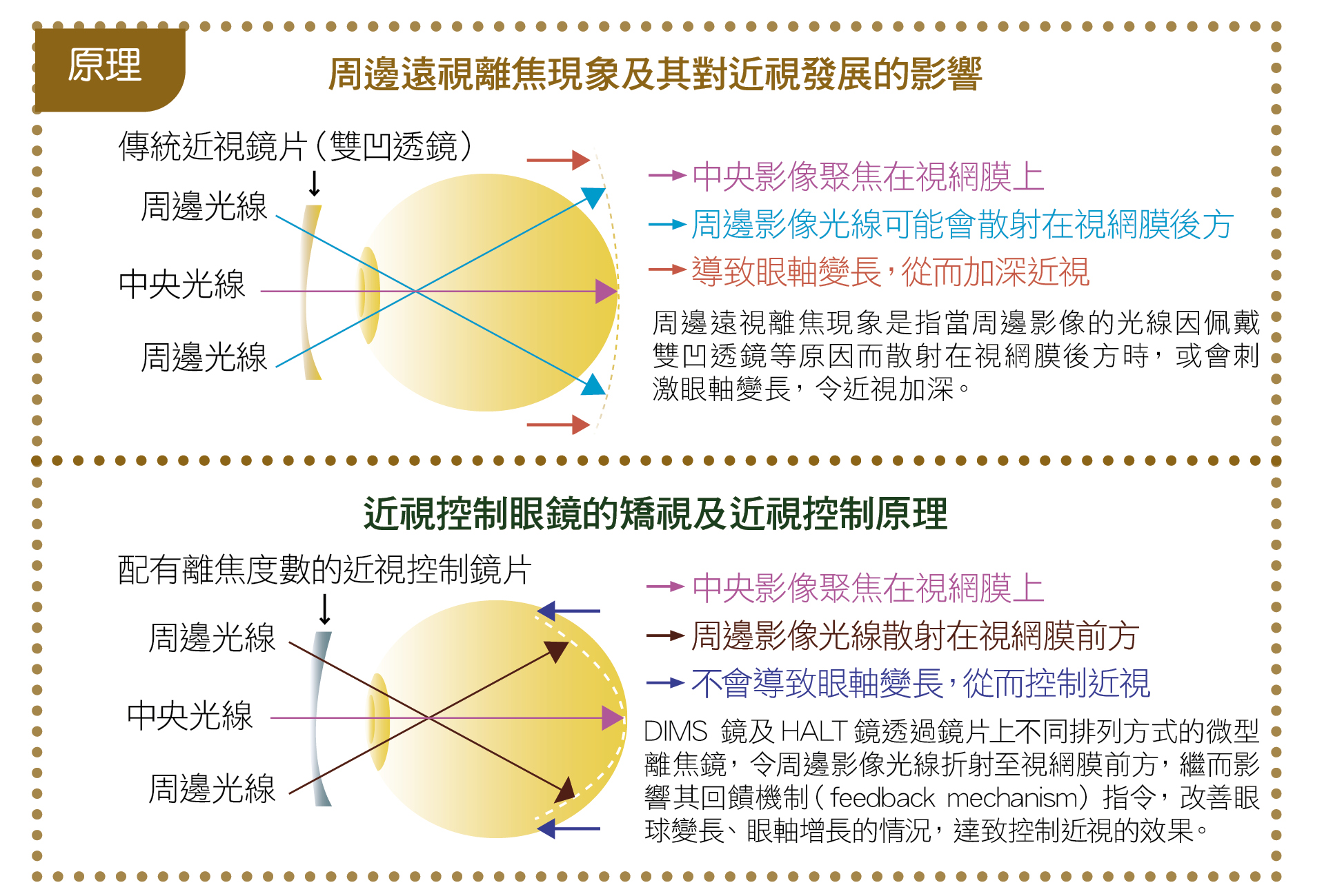 光學近視控制方法