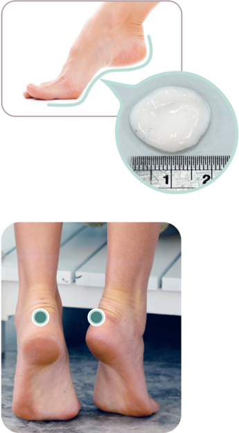 (上)試用者使用足部護理霜樣本時，每次用量約為0.5克，直徑相等於港幣5毫子的分量（如圖示），以及塗搽的腳踭和腳底範圍。(下) 試驗量度試用者腳踭後方中央位置的皮膚水分含量（如圖中所指位置）。