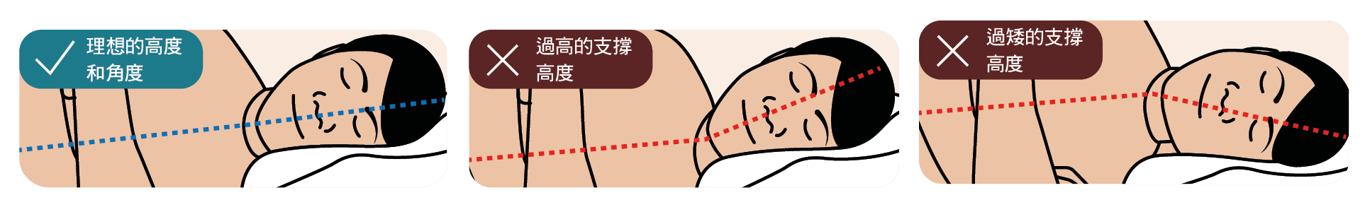 图4：侧卧的头部角度 