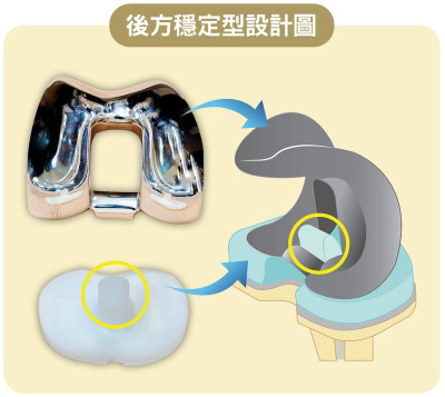 后方稳定型的绘图