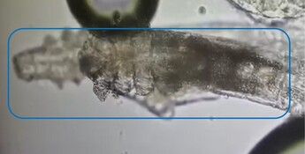 图:显微镜下的毛囊蟎虫