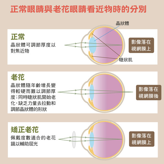 老花的成因