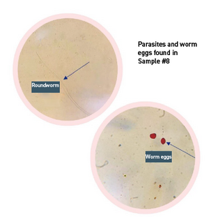 Parasites and worm eggs found in Sample #8, Roundworm, Worm eggs