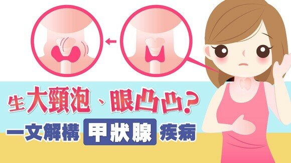 生「大頸泡」、眼凸凸？一文解構甲狀腺疾病