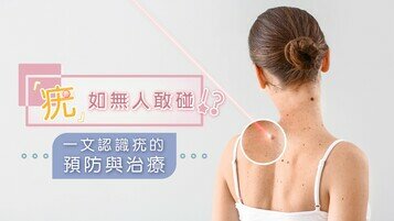 【生疣冷知識】搭𨋢、游水易中招？具高度傳染性？