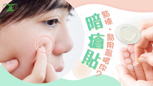 《暗瘡護理指南！暗瘡貼點揀、點用最啱你？》