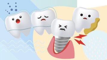 Quality of Dental Services Varies Seek Reputable Service Providers to Avoid Distress Be Mindful of Details when Using Dental Services in the Mainland to Protect Consumer Rights